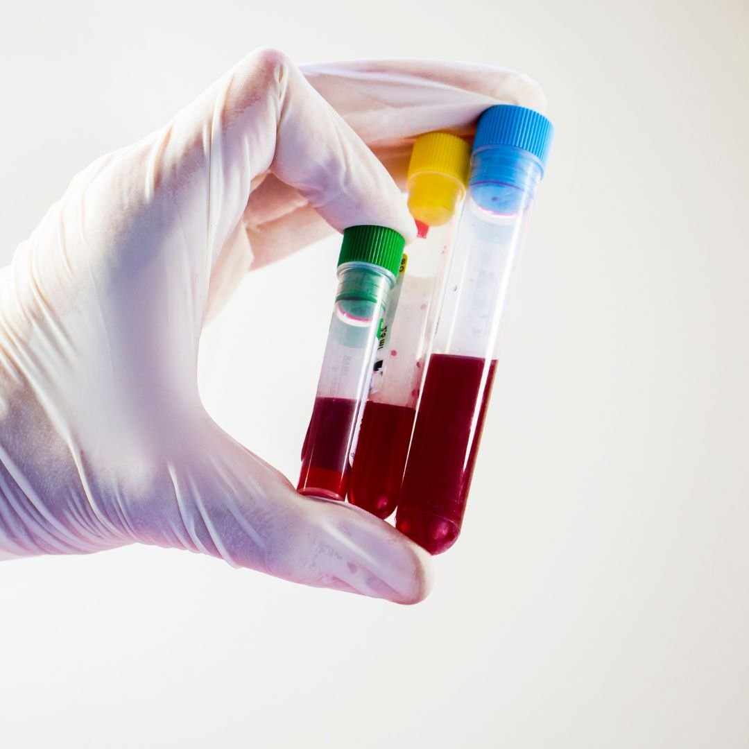 Blood sample tubes for thyroid function testing
