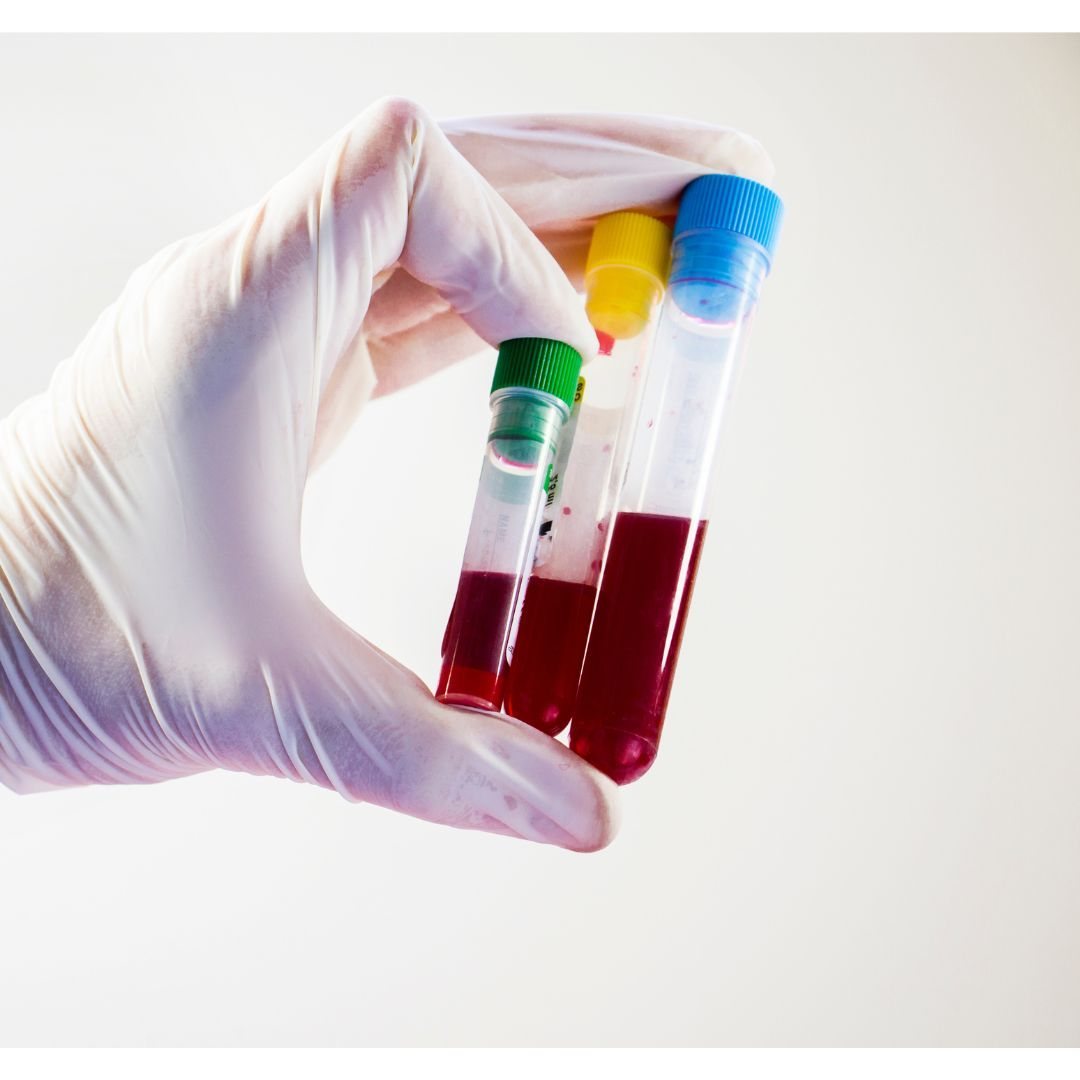 Thyroid blood test results being explained